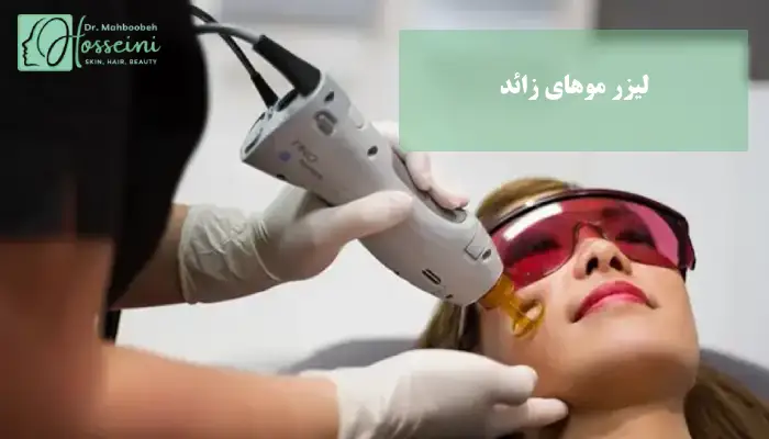 لیزر موهای زائد چیست؟