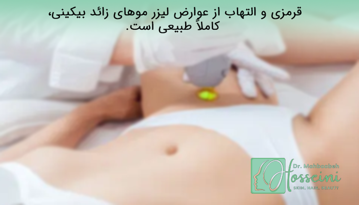 عوارض لیزر واژن، شخصی درحال لیزر