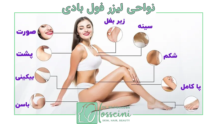 : تصویر آموزشی نواحی مختلف بدن برای لیزر موهای زائد شامل صورت، زیر بغل، سینه، پشت و پاها