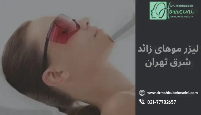 لیزر موهای زائد در شرق تهران