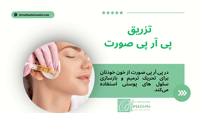 تزریق پی آر پی صورت