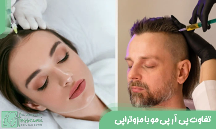 تفاوت پی آر پی مو با مزوتراپی