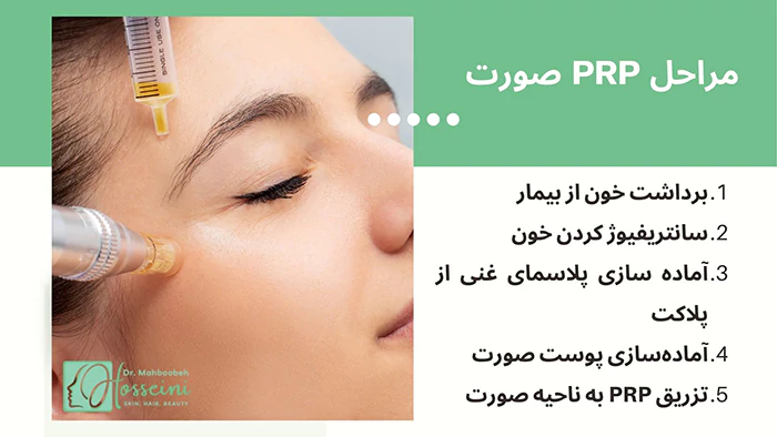 مراحل PRP صورت