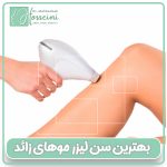 بهترین سن لیزرموهای زائد بدن در تهران با دکتر محبوبه حسینی