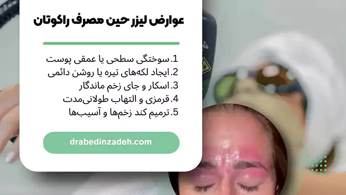عوارض لیزر حین مصرف راکوتان