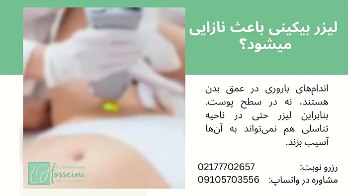 لیزر بیکینی باعث نازایی میشود؟