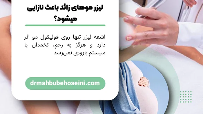 لیزر موهای زائد باعث نازایی میشود