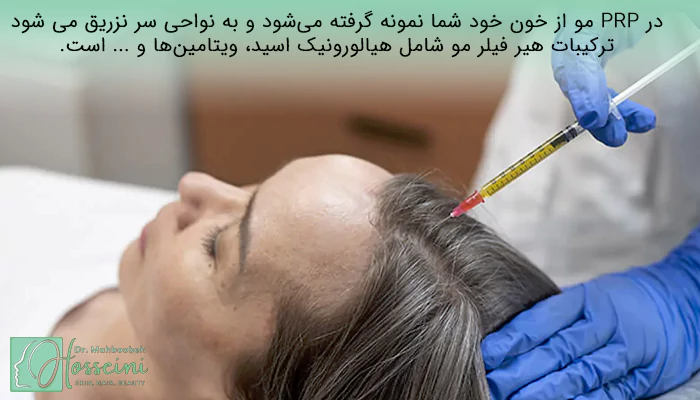 پی آر پی مو بهتره یا هیر فیلر