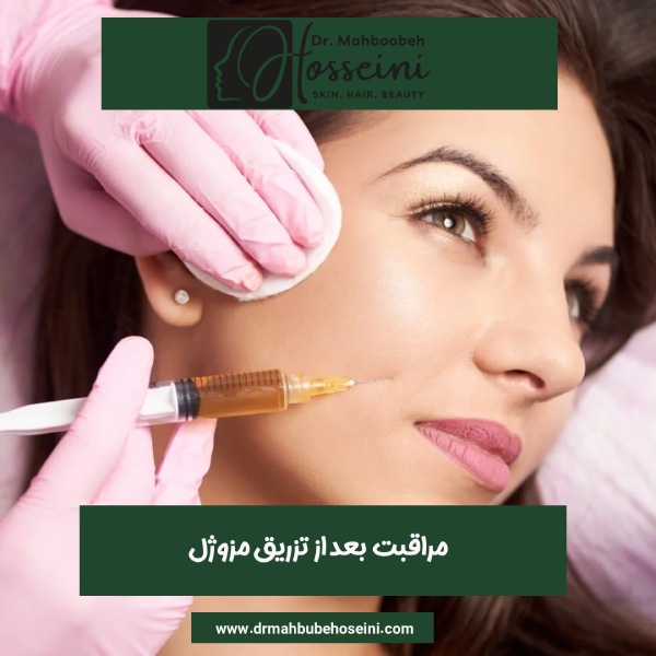 مراقبت بعد از تزریق مزوژل