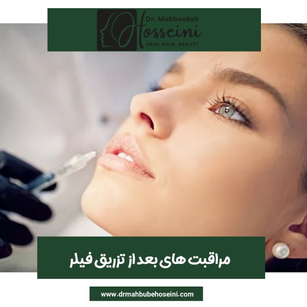 مراقبت های بعد از تزریق فیلر