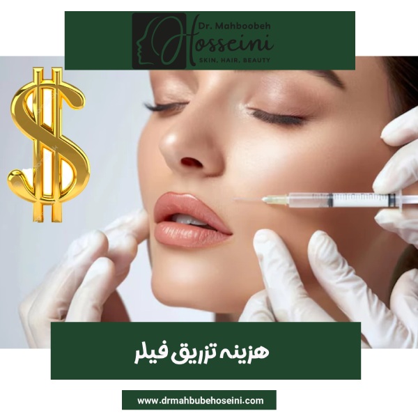 هزینه تزریق فیلر