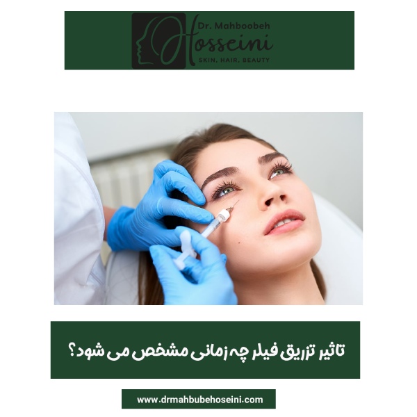 تاثیر تزریق فیلر