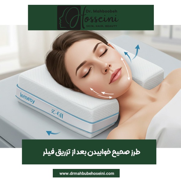 طزر صحیح خوابیدن بعد از تزریق فیلر