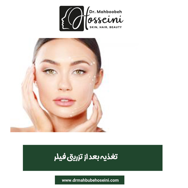 تغذیه بعد از تزریق فیلر